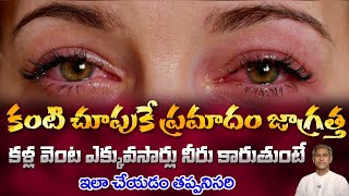 How to Improve Eyes Health  Effects of Watery Eyes  Dry Eyes  Dr Manthenas Health Tips [upl. by Pittman605]