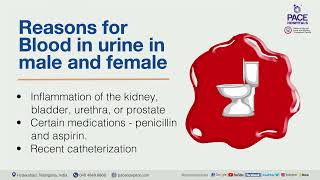 Blood in urine  Hematuria  Causes Symptoms Risk Factors and Treatment [upl. by Nosniv546]