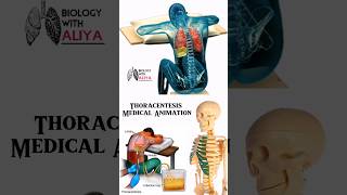 Thoracentesis Medical Animation  biology With Aliya medical animation 3d short [upl. by Anyahs]