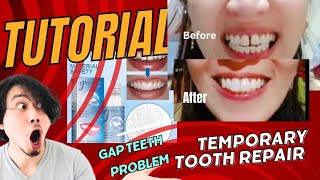 Tutorial how to use Temporary Moldable False Teeth on Gap teeth [upl. by Kerby]