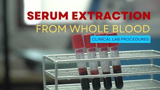 Serum Extraction from Whole Blood [upl. by Nomannic376]