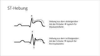 EKG verstehen die Grundlagen EKG Crashkurs Teil 1 [upl. by Lyford]