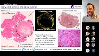 Cox T 2022 Tumour microenvironment [upl. by Aerdnak]