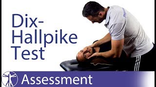 Dix Hallpike Test  Posterior BPPV [upl. by Japeth]