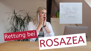 Rettung bei Rosazea  Couperose  Vorbeugung  Triggerfaktoren  Pflegetipps  Therapie [upl. by Ynahteb129]