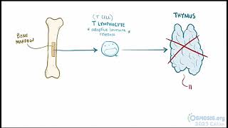 Digeorge Syndrome Osmosis [upl. by Clarine118]