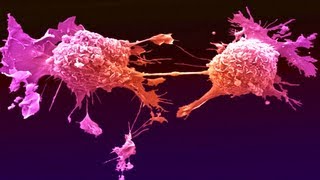 New Cancer Drug Shrinks All Tumors [upl. by Weinrich]