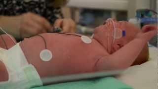 LowCost Cooling Cure Could Avert Brain Damage in OxygenStarved Babies [upl. by Dorita]