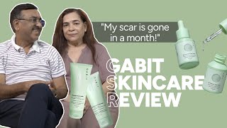 quotMy scar is gone in a monthquot  Gabit Skincare Review [upl. by Hannej]