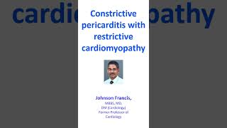 Constrictive pericarditis with restrictive cardiomyopathy [upl. by Ydurt]