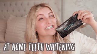 At Home Teeth Whitening  Boutique Whitening  My Teeth Bleaching Journey [upl. by Nylatsirhc]