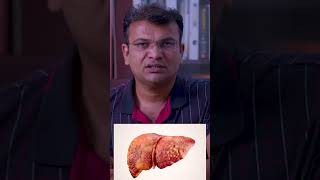 Fibroscan करते कब है और कैसे  fibroscan fibroscantest fibroscanliver fibroscandevice [upl. by Imim232]