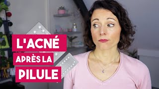 Comment gérer lacné hormonale après larrêt de la pilule [upl. by Alduino]