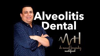 ¿Cómo evitar la alveolitis dental [upl. by Aidua]