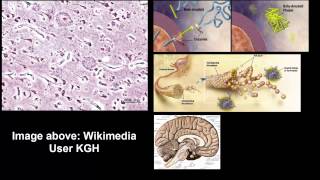 Biological basis of alzheimers disease [upl. by Ainehs]