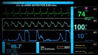 Sonido De Un Hospital [upl. by Llennahs]