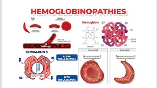 Hemoglobinopathies Resulting in Hereditary Hemolytic Anemia  Unstable hemoglobin Thalassemias [upl. by Ahsinac559]