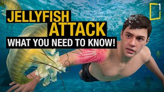 The Shocking Truth About Jellyfish Stings and How to Avoid Them [upl. by Ahsirahc671]