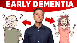 The 10 WARNING Signs of Dementia [upl. by Nawk669]