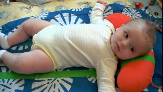 Evan six months infantile spasms  West Syndrome [upl. by Suirrad506]