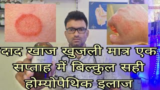 Best Homeopathic medicine for allergyRingworm eczema skin disease [upl. by Caralie11]