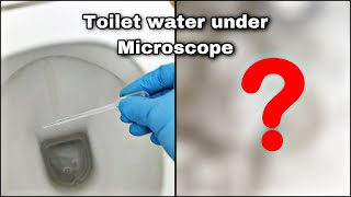 Toilet water under microscope 😱 [upl. by Esra426]