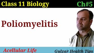 Poliomyelitis  Its symptoms Causes Prevention amp Treatment  class 11 biology [upl. by Neerol]