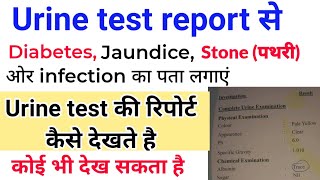 urine test report देखना सीखे  Urine test report कैसे देखते है  Pus cell  Protein  Sugar Cast [upl. by Nomad]