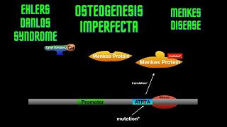 USMLE Step 1  Lesson 23  Osteogenesis Imperfecta Ehlers Danlos Syndrome and Menkes disease [upl. by Ynaffad1]