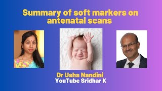 Summary of soft markers on antenatal scans screening pregnancy trisomy softmarkers [upl. by Pembrook]