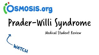 PraderWilli Syndrome Osmosis Study Video [upl. by Hugibert925]