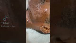 Chin waxing help to remove hair from the roots spavideo waxingtutorial facialhairremoval waxing [upl. by Suoivatram]