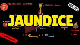 JAUNDICE Classification Pathogenesis Types of Jaundice Why urine is yellow [upl. by Naquin]