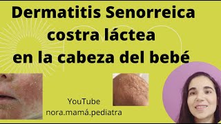 Que es la Dermatitis seborreica infantil Y como tratar la Costra láctea [upl. by Ahsayn763]