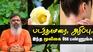 Ringworm Treatment At Home  படர்தாமரை பரவுவதை எவ்வாறு தடுப்பது  Advice from Dr K Gowthaman [upl. by Eiramana]