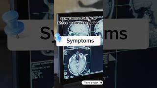 What is Schizophrenia  schizophrenia symptoms causes and Treatment schizophrenia neuroscience [upl. by Anilorak]