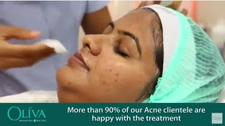 Pimples Treatment In Hyderabad  Acne Removal Treatment In Hyderabad [upl. by Shuman]