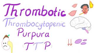 Thrombotic Thrombocytopenic Purpura TTP [upl. by Idelia]