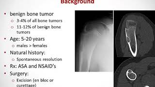 Radiofrequency Ablation of Osteoid Osteoma with Use of Intraoperative Three Dimensional Imaging [upl. by Medor487]