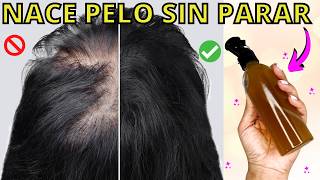 ✅SE TE CAE EL PELO👉 USA ESTE REMEDIO POTENTE EN LA SEMANA Y TU CABELLO NO PARARA DE CRECER😱 [upl. by Hoagland]