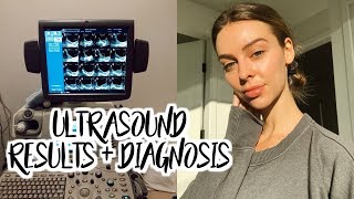 Ultrasound Results Diagnosis Health Updates My Plan [upl. by Eibocaj]