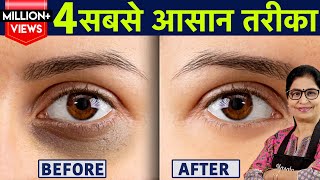 1 ही रात मे आंखों के काले घेरे हटाने के घरेलू नुस्खे  Dark Circles Kaise Hataye Remove Dark Circle [upl. by Isa283]