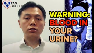 YOU Need To Know About Blood In The Urine  Spot The Warning Signs Early [upl. by Presley]