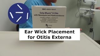 Ear Wick Placement for Otitis Externa [upl. by Akinnej]