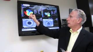 DR BOSHNICK EXPLAINING CORNEAL TOPOGRAPHY PATIENT 4 [upl. by Adnihc]