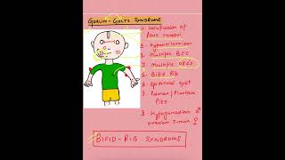 Gorlin Goltz syndrome  Bifid Rib syndrome  Oral Pathology  bds oralpathology syndromes mds [upl. by Martinelli]