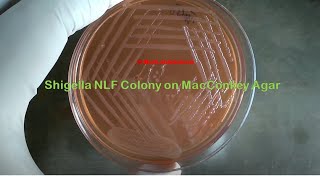 Nonlactose fermenter colony of Shigella [upl. by Ahab668]