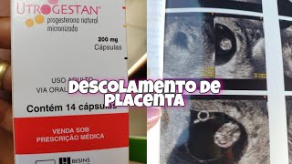 DESCOLAMENTO DE PLACENTA 8 SEMANAS DE GESTAÇÃO [upl. by Oileve705]