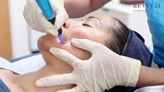 Microneedling Full Training Video [upl. by Helmer725]