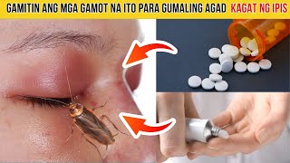 TOP 5 na EFFECTIVE na GAMOT para sa KAGAT NG IPIS [upl. by Annatsirhc71]